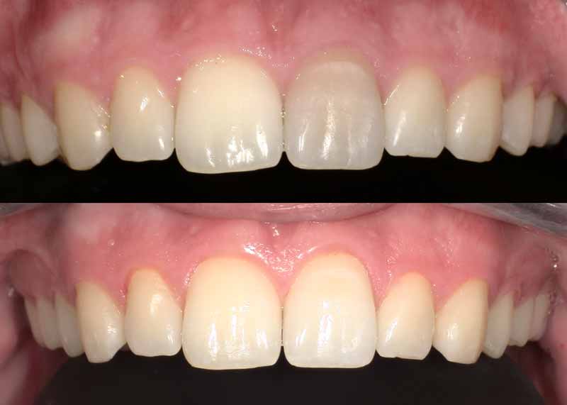 Moderne Endodontie-Ausrüstung und Instrumente für schonende Wurzelbehandlungen in der Praxis Zahn im Zentrum