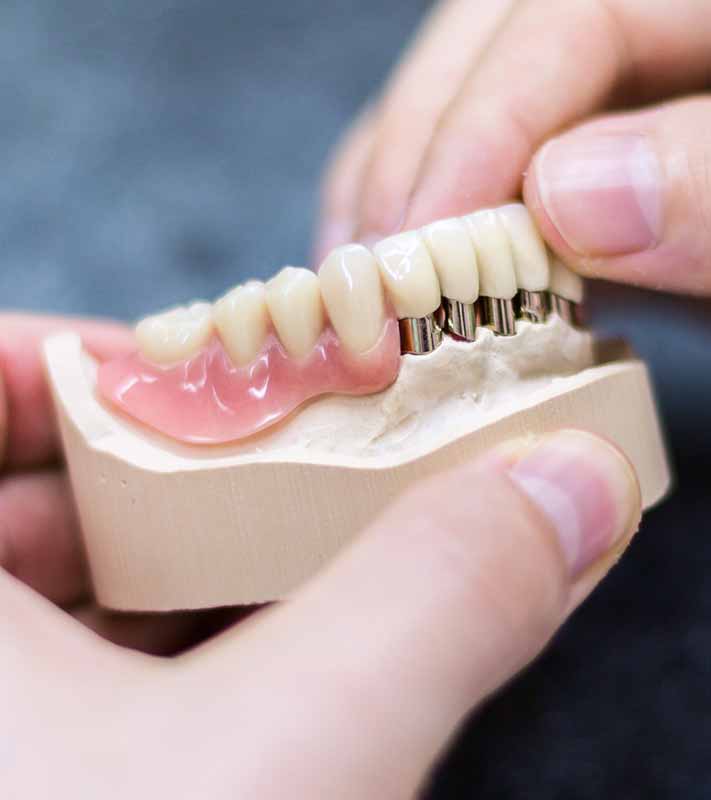 Hochwertiger Zahnersatz gefertigt im eigenen Labor – präzise Anpassung für optimale Funktion und Ästhetik